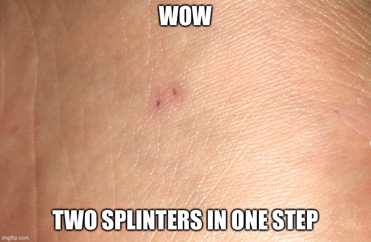 At least I have two souvenirs from my trip to the beach :) | WOW; TWO SPLINTERS IN ONE STEP | image tagged in splinter,oof,unlucky | made w/ Imgflip meme maker
