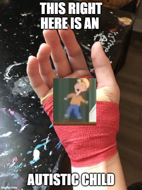 hand meme | THIS RIGHT HERE IS AN; AUTISTIC CHILD | image tagged in finny1312 | made w/ Imgflip meme maker