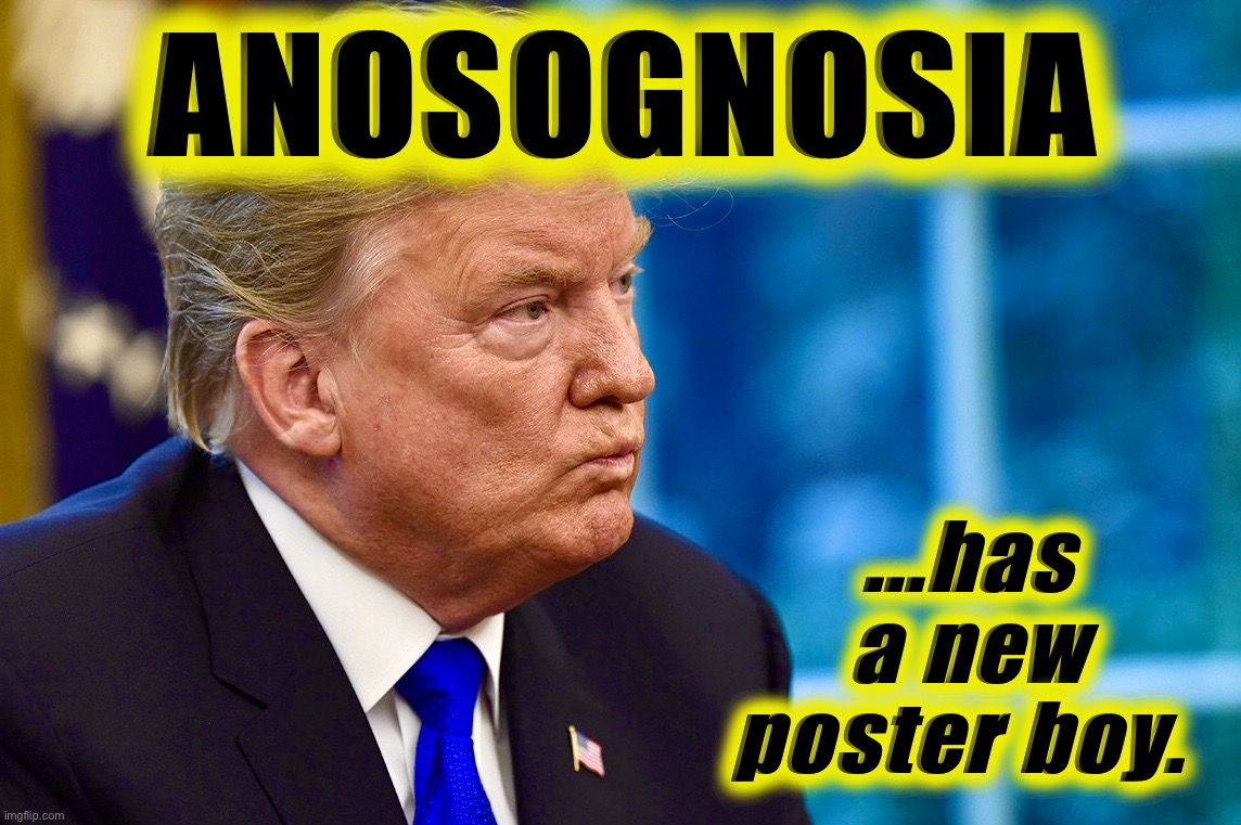 Dum dum duuuummmm | ANOSOGNOSIA; ...has a new poster boy. | image tagged in donald trump is an idiot,memes,captain trumps,conspiracy theory,covidiots,word of the day | made w/ Imgflip meme maker