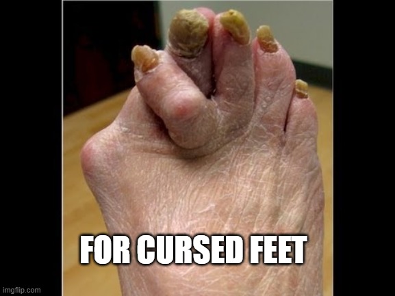 ugly feet | FOR CURSED FEET | image tagged in ugly feet | made w/ Imgflip meme maker