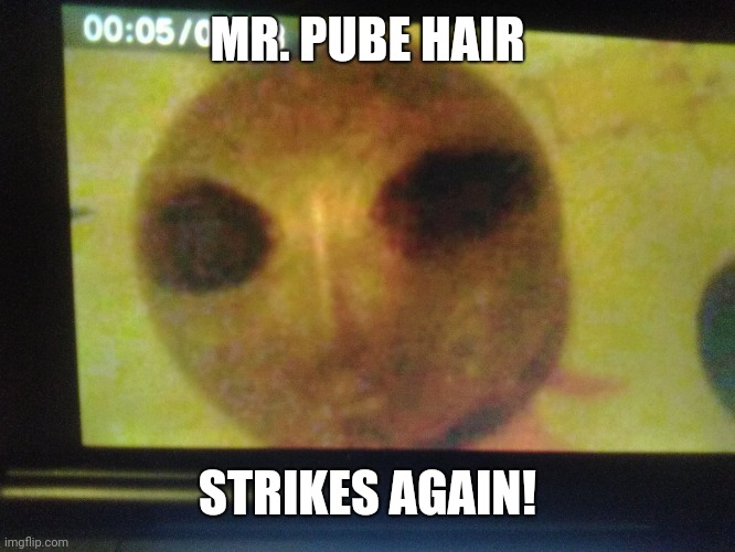 Guess Who??  XD | MR. PUBE HAIR; STRIKES AGAIN! | image tagged in mr pube hair,xd,lol,funny,mr pube hair strikes again,yeet boi | made w/ Imgflip meme maker