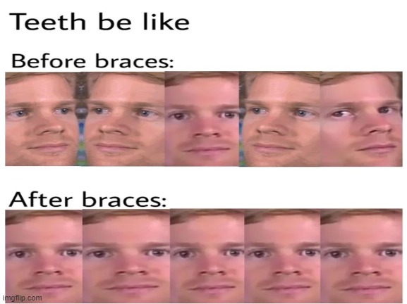 Braces are lifesavers | image tagged in memes,white guy blinking | made w/ Imgflip meme maker