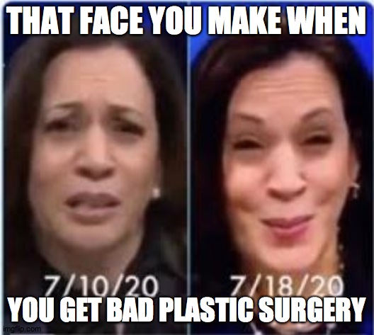 THAT FACE YOU MAKE WHEN; YOU GET BAD PLASTIC SURGERY | image tagged in kamala harris | made w/ Imgflip meme maker