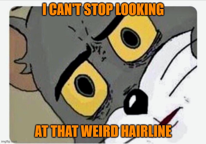 Disturbed Tom | I CAN'T STOP LOOKING AT THAT WEIRD HAIRLINE | image tagged in disturbed tom | made w/ Imgflip meme maker