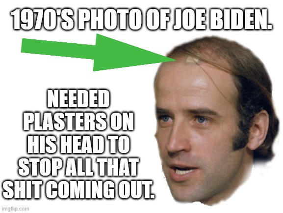 Joe Biden in the 70's in his pre hair plug days.Full of shit then and still producing like there's no tomorrow. | 1970'S PHOTO OF JOE BIDEN. NEEDED PLASTERS ON HIS HEAD TO STOP ALL THAT SHIT COMING OUT. | image tagged in joe biden,joe full of shit,joe pedophile,joey plasters,bidens a muppet,biden leaks shit from head | made w/ Imgflip meme maker