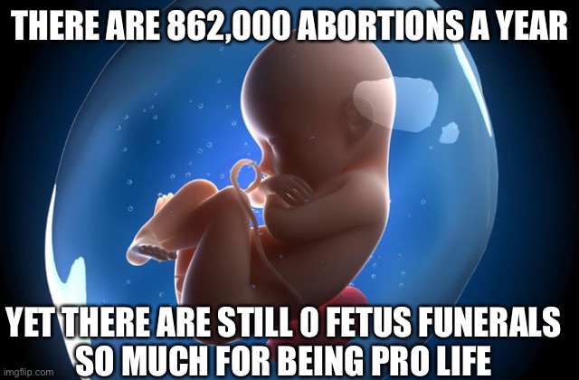 Pro life... sure | THERE ARE 862,000 ABORTIONS A YEAR; YET THERE ARE STILL 0 FETUS FUNERALS
SO MUCH FOR BEING PRO LIFE | image tagged in pro life | made w/ Imgflip meme maker
