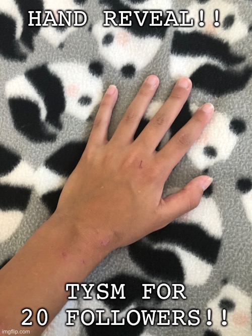 Sorry my hand has scratches all over it .-. | HAND REVEAL!! TYSM FOR 20 FOLLOWERS!! | image tagged in hand reveal,reveal,thank you | made w/ Imgflip meme maker