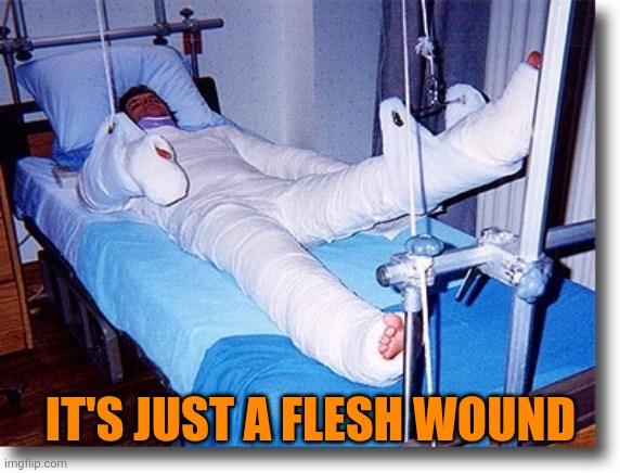 IT'S JUST A FLESH WOUND | made w/ Imgflip meme maker