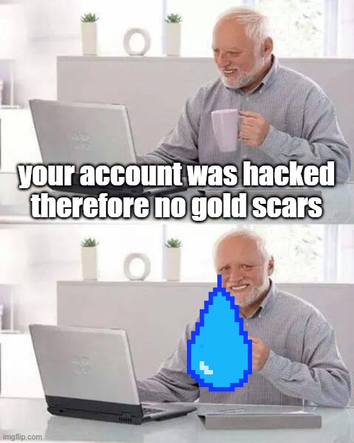 Hide the Pain Harold Meme | your account was hacked therefore no gold scars | image tagged in memes,hide the pain harold | made w/ Imgflip meme maker
