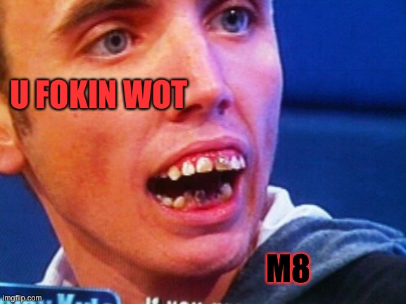 British Teeth  | U FOKIN WOT M8 | image tagged in british teeth | made w/ Imgflip meme maker