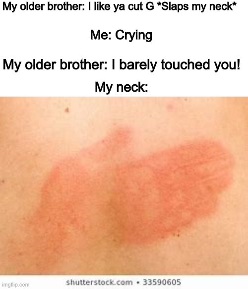 Can yall relate? | My older brother: I like ya cut G *Slaps my neck*; Me: Crying; My older brother: I barely touched you! My neck: | image tagged in relatable | made w/ Imgflip meme maker
