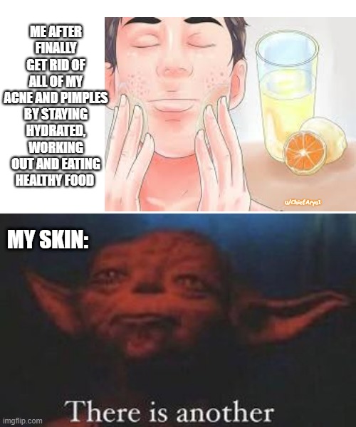 it never goes away | ME AFTER FINALLY GET RID OF ALL OF MY ACNE AND PIMPLES BY STAYING HYDRATED, WORKING OUT AND EATING HEALTHY FOOD; u/ChiefArya1; MY SKIN: | image tagged in yoda there is another,funny,memes | made w/ Imgflip meme maker