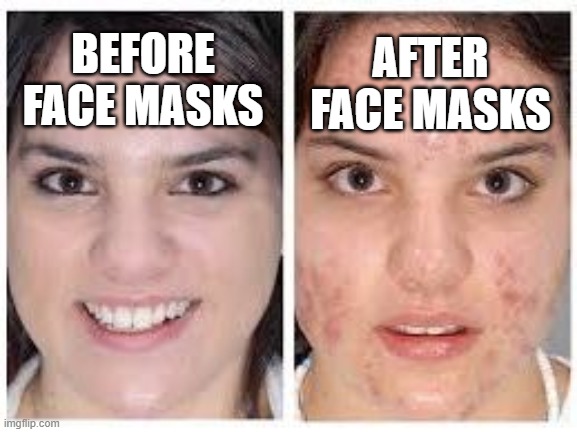 Thanks China | AFTER FACE MASKS; BEFORE FACE MASKS | image tagged in before and after acne meme,memes,covid-19,china | made w/ Imgflip meme maker