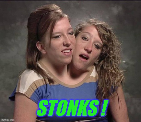 Conjoined twins | STONKS ! | image tagged in conjoined twins | made w/ Imgflip meme maker