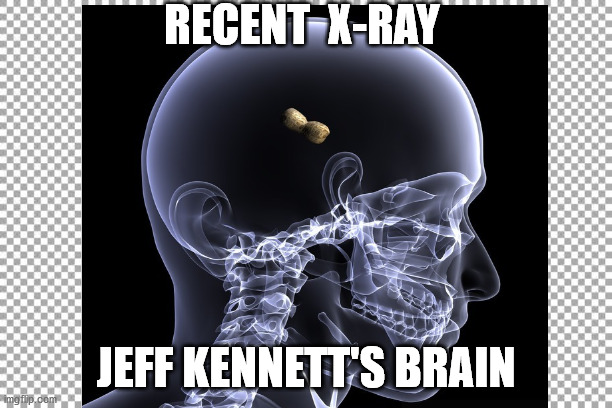 Jeff Kennett's Brain | RECENT  X-RAY; JEFF KENNETT'S BRAIN | image tagged in politics,victorian,jeff kennett | made w/ Imgflip meme maker