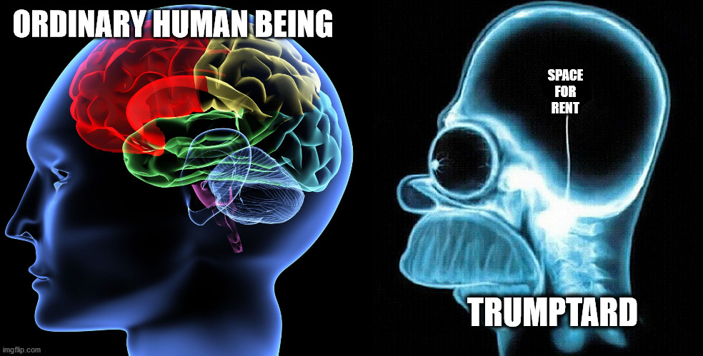 Brain versus Homer Brain | ORDINARY HUMAN BEING SPACE
FOR
RENT TRUMPTARD | image tagged in brain versus homer brain | made w/ Imgflip meme maker