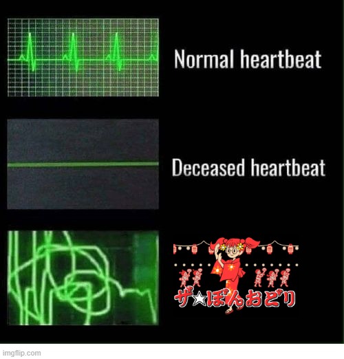 normal heartbeat deceased heartbeat | image tagged in normal heartbeat deceased heartbeat,rhythm heaven,the bon-odori | made w/ Imgflip meme maker