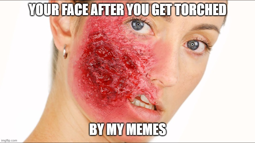 meme war ammo | YOUR FACE AFTER YOU GET TORCHED; BY MY MEMES | image tagged in burn,savage,meme war,ammo,funny memes | made w/ Imgflip meme maker