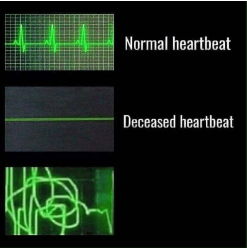 High Quality heartbeat, normal heartbeat, deceased heartbeat, Blank Meme Template