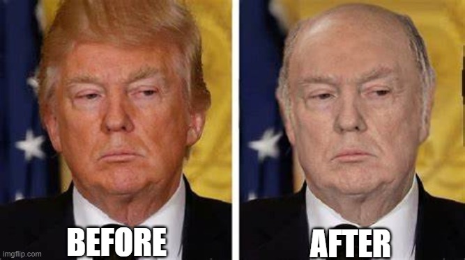 Trump Skin | BEFORE; AFTER | image tagged in trump skin | made w/ Imgflip meme maker