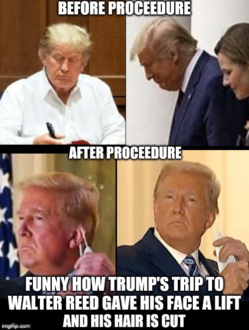He Is A Reality Tv Show Host After All | BEFORE PROCEEDURE; AFTER PROCEEDURE; FUNNY HOW TRUMP'S TRIP TO WALTER REED GAVE HIS FACE A LIFT; AND HIS HAIR IS CUT | image tagged in double long black template,memes,trump unfit unqualified dangerous,liar in chief,liar,trump lies | made w/ Imgflip meme maker