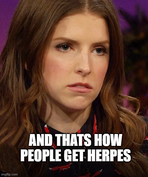 Anna Kendrick | AND THATS HOW PEOPLE GET HERPES | image tagged in anna kendrick | made w/ Imgflip meme maker
