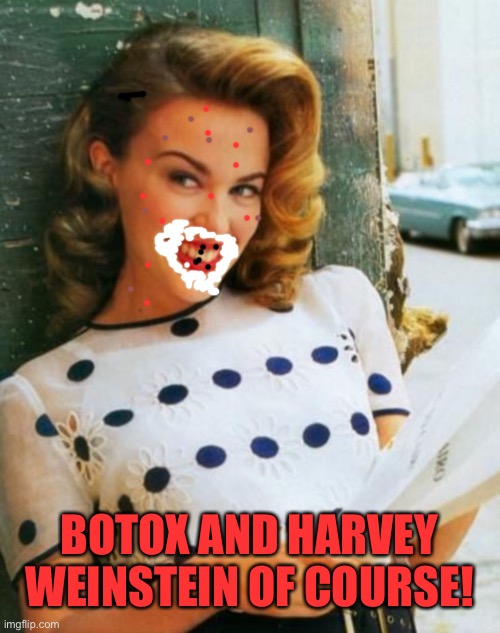 Kylie young | BOTOX AND HARVEY WEINSTEIN OF COURSE! | image tagged in kylie young | made w/ Imgflip meme maker