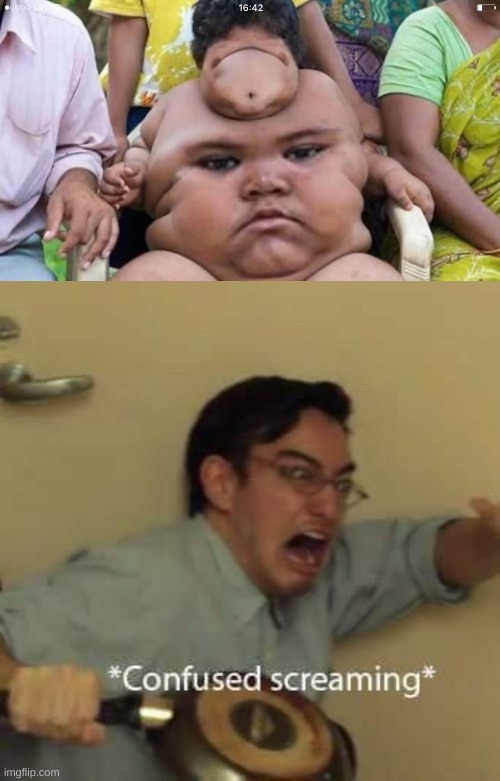 Um... | image tagged in filthy frank confused scream,face swap | made w/ Imgflip meme maker
