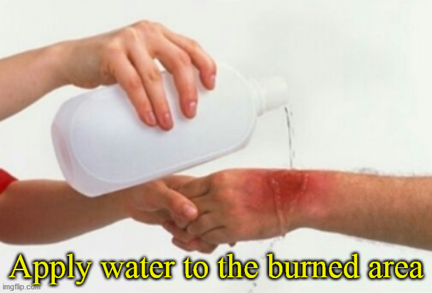 Apply water | Apply water to the burned area | image tagged in apply water | made w/ Imgflip meme maker