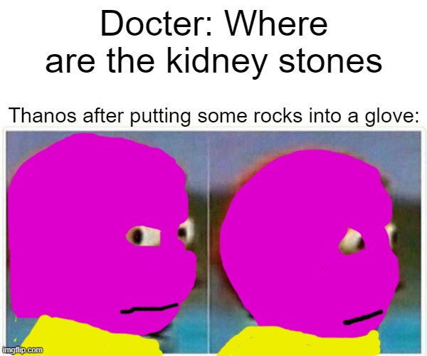 Monkey Puppet Meme | Docter: Where are the kidney stones; Thanos after putting some rocks into a glove: | image tagged in memes,monkey puppet | made w/ Imgflip meme maker