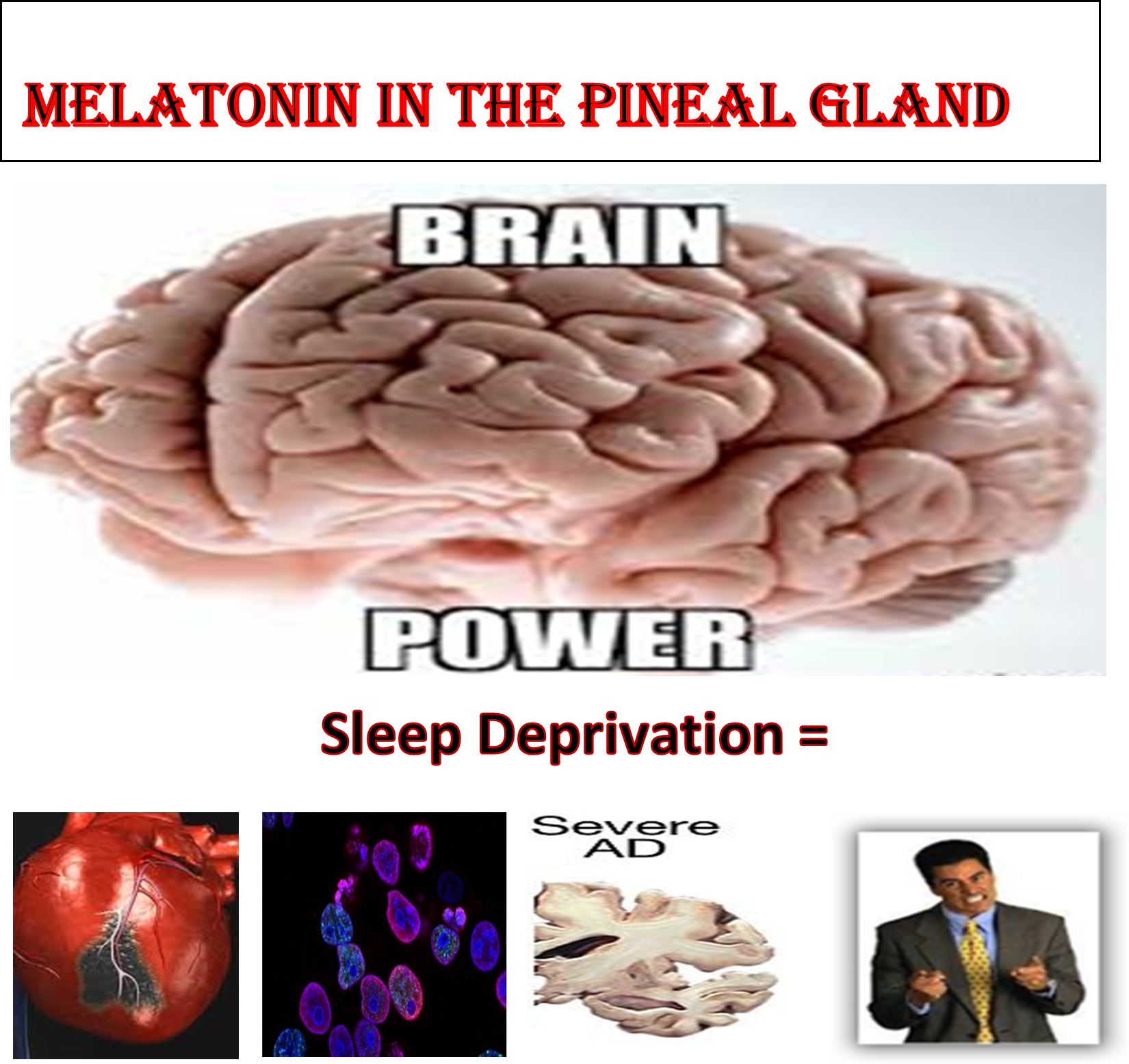 sleep deprivation and the brain Blank Meme Template