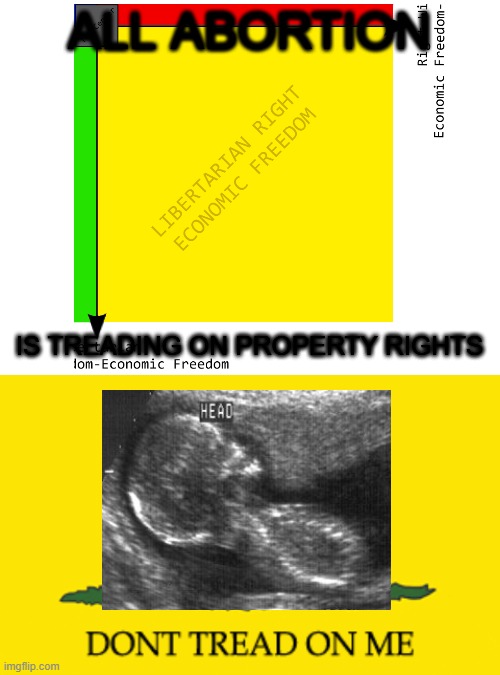 ALL ABORTION IS TREADING ON PROPERTY RIGHTS | image tagged in blank white template | made w/ Imgflip meme maker