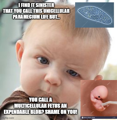 Shame on Abortionists! |  I FIND IT SINISTER THAT YOU CALL THIS UNICELLULAR PARAMECIUM LIFE BUT... YOU CALL A MULTICELLULAR FETUS AN EXPENDABLE BLOB? SHAME ON YOU! | image tagged in memes,skeptical baby | made w/ Imgflip meme maker