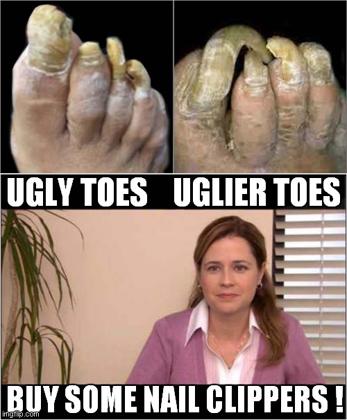 Nature Is Very Weird | UGLY TOES    UGLIER TOES; BUY SOME NAIL CLIPPERS ! | image tagged in toes,nails,they're the same picture,frontpage | made w/ Imgflip meme maker