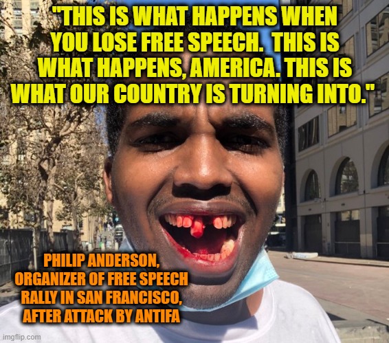 Antifa Versus Free Speech | "THIS IS WHAT HAPPENS WHEN YOU LOSE FREE SPEECH.  THIS IS WHAT HAPPENS, AMERICA. THIS IS WHAT OUR COUNTRY IS TURNING INTO."; PHILIP ANDERSON, ORGANIZER OF FREE SPEECH RALLY IN SAN FRANCISCO, AFTER ATTACK BY ANTIFA | image tagged in free speech,antifa | made w/ Imgflip meme maker