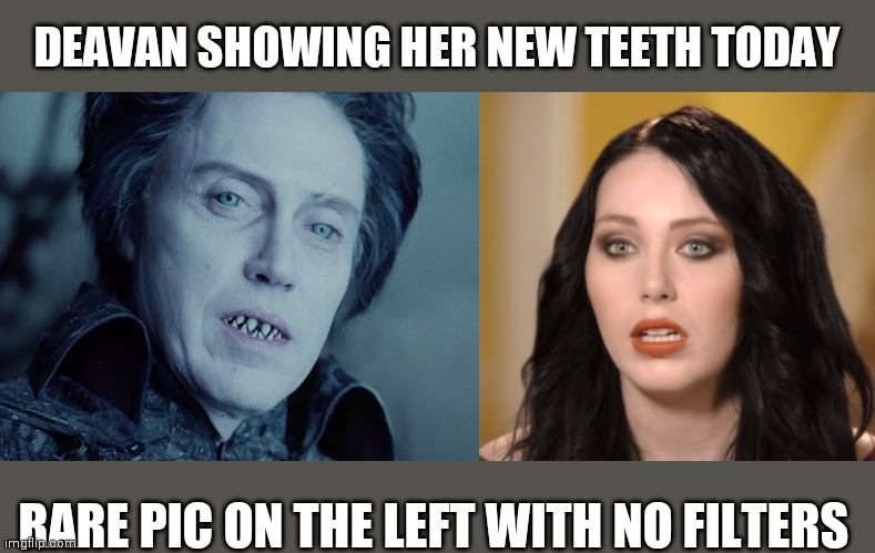 DEAVAN SHOWING HER NEW TEETH TODAY; RARE PIC ON THE LEFT WITH NO FILTERS | made w/ Imgflip meme maker
