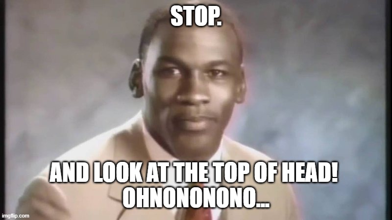 Stop. And look at the TOP OF HIS HEAD! | STOP. AND LOOK AT THE TOP OF HEAD! 
OHNONONONO... | image tagged in stop get some help | made w/ Imgflip meme maker