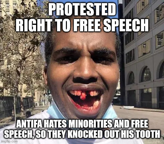 PROTESTED RIGHT TO FREE SPEECH ANTIFA HATES MINORITIES AND FREE SPEECH, SO THEY KNOCKED OUT HIS TOOTH | made w/ Imgflip meme maker