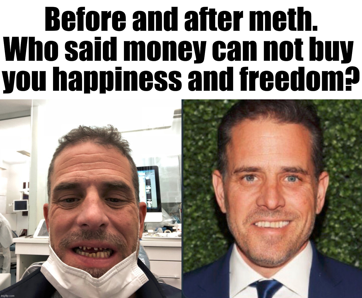 I had friends who did meth and they can not erase it's effects like the Biden's did for their kid. | Before and after meth. Who said money can not buy 
you happiness and freedom? | image tagged in meth,hunter,biden,joe biden,money,corruption | made w/ Imgflip meme maker