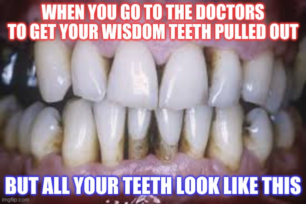 WAPeriodontitis | WHEN YOU GO TO THE DOCTORS TO GET YOUR WISDOM TEETH PULLED OUT; BUT ALL YOUR TEETH LOOK LIKE THIS | made w/ Imgflip meme maker