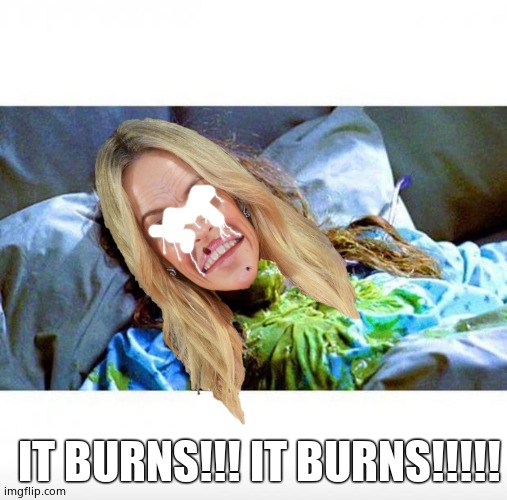 The Exorwhore | IT BURNS!!! IT BURNS!!!!! | image tagged in kylie minogue,kylieminoguesucks,the exorwhore | made w/ Imgflip meme maker