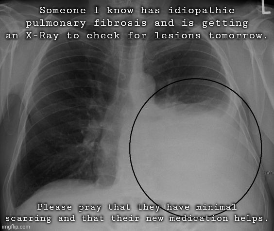lung | Someone I know has idiopathic pulmonary fibrosis and is getting an X-Ray to check for lesions tomorrow. Please pray that they have minimal scarring and that their new medication helps. | image tagged in lung | made w/ Imgflip meme maker