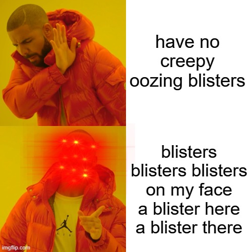 omg drake what happened to you?! | have no creepy oozing blisters; blisters blisters blisters on my face a blister here a blister there | image tagged in memes,drake hotline bling | made w/ Imgflip meme maker