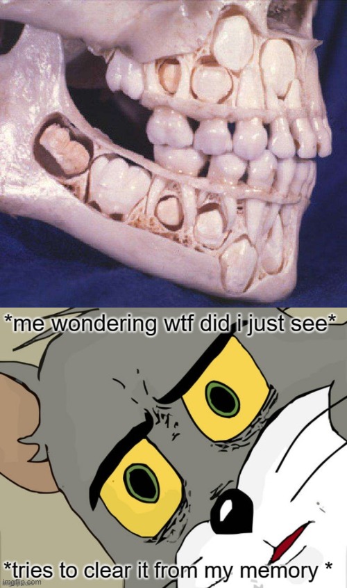 we were all like this when we were younger... | image tagged in cursed image,unsettled tom,memes,teeth | made w/ Imgflip meme maker