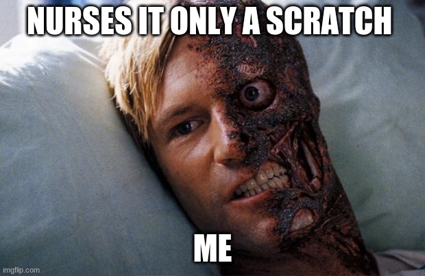Two Face | NURSES IT ONLY A SCRATCH; ME | image tagged in two face | made w/ Imgflip meme maker