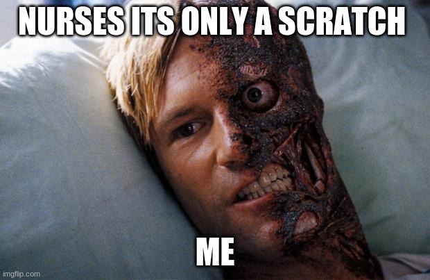Two Face | NURSES ITS ONLY A SCRATCH; ME | image tagged in two face | made w/ Imgflip meme maker