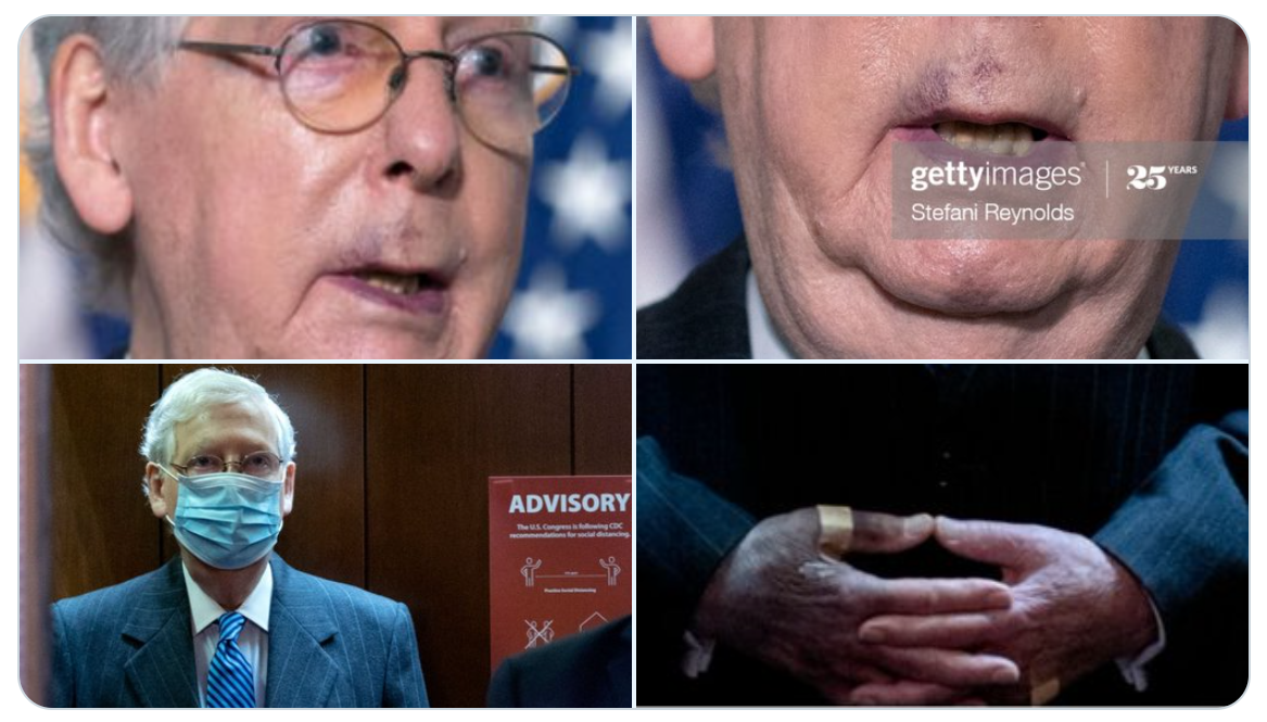 mitch mcconnell hands Blank Meme Template
