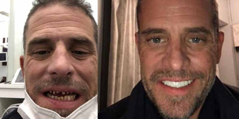 High Quality Hunter Biden meth mouth before and after Blank Meme Template