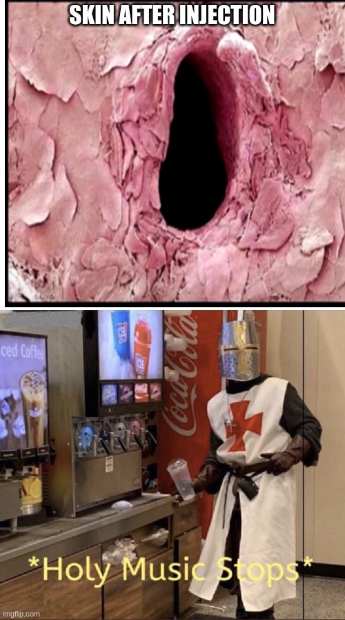Holy music stops | SKIN AFTER INJECTION | image tagged in holy music stops | made w/ Imgflip meme maker