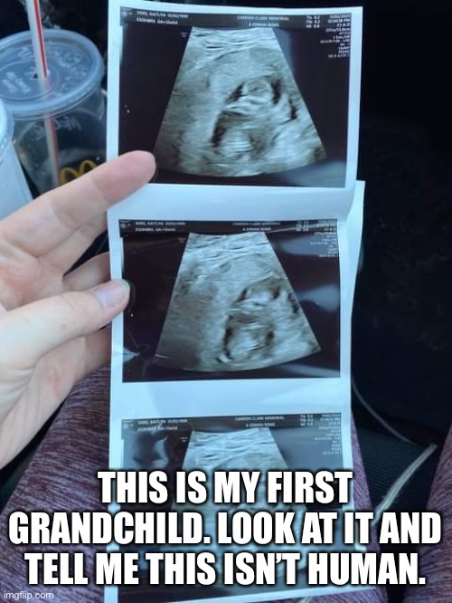 THIS IS MY FIRST GRANDCHILD. LOOK AT IT AND TELL ME THIS ISN’T HUMAN. | made w/ Imgflip meme maker